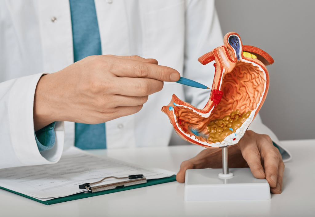 Le protocole Fodmaps, réellement efficace pour le Syndrome de l’Intestin Irritable ?
